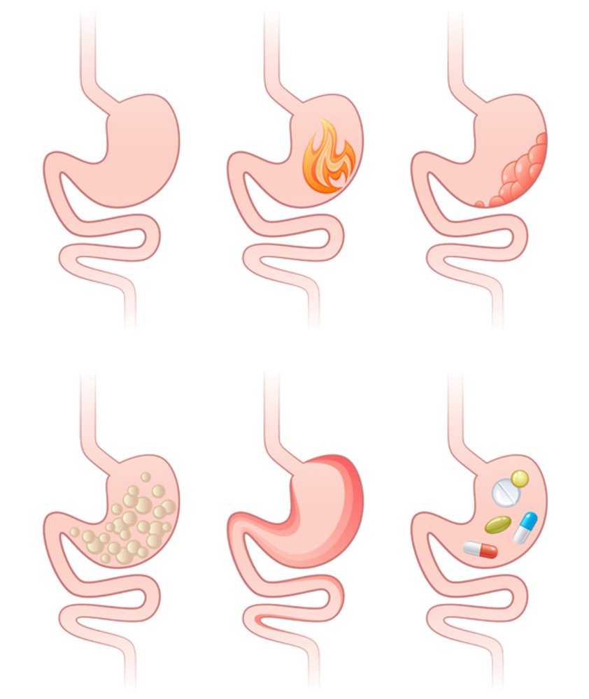 Limpieza intestinal 1er paso: purgar los intestinos.